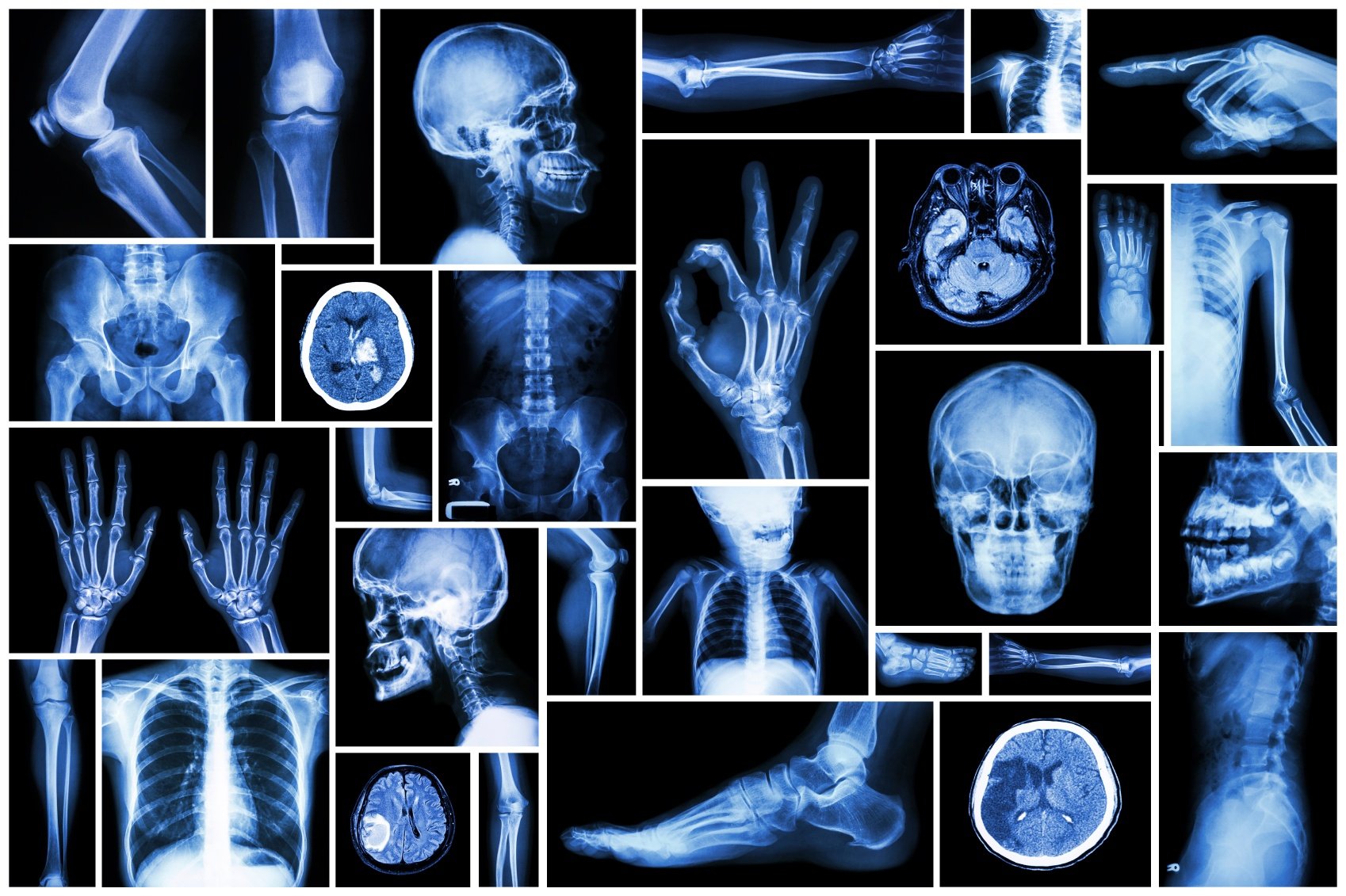 x-ray-scans-of-different-body-parts
